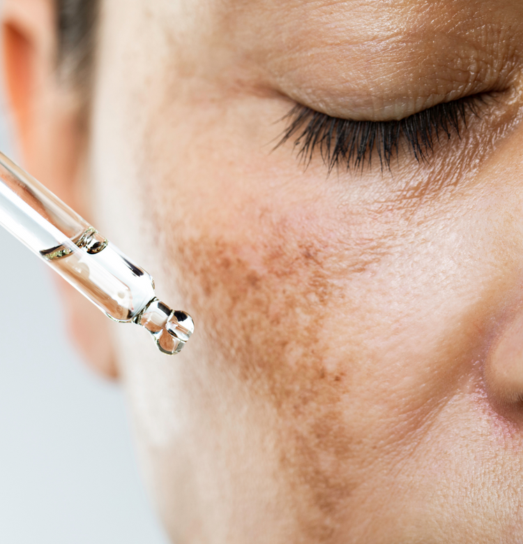 Dark Spot Treatment