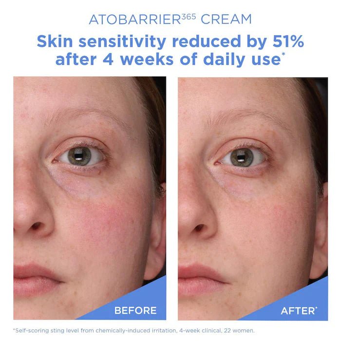 AESTURA Atobarrier365 Cream - Daebak