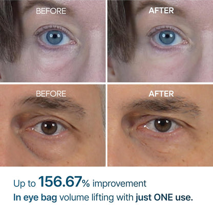 Dr. Melaxin Eyephalt Eyebag Cream - Daebak