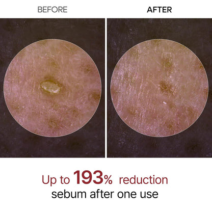 Dr. Melaxin Peel Shot Exfoliant Black Rice Ampoule - Daebak