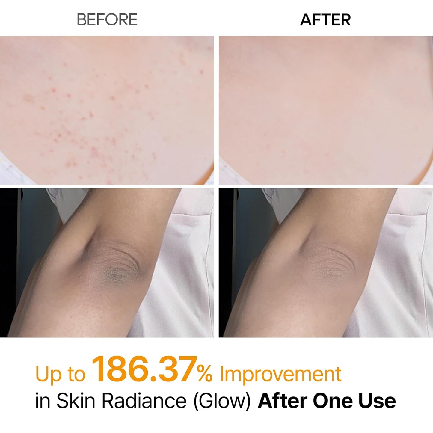 Dr. Melaxin Peel Shot Exfoliating Kojic Acid Turmeric Spray - Daebak
