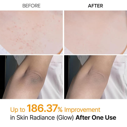 Dr. Melaxin Peel Shot Exfoliating Kojic Acid Turmeric Spray - Daebak