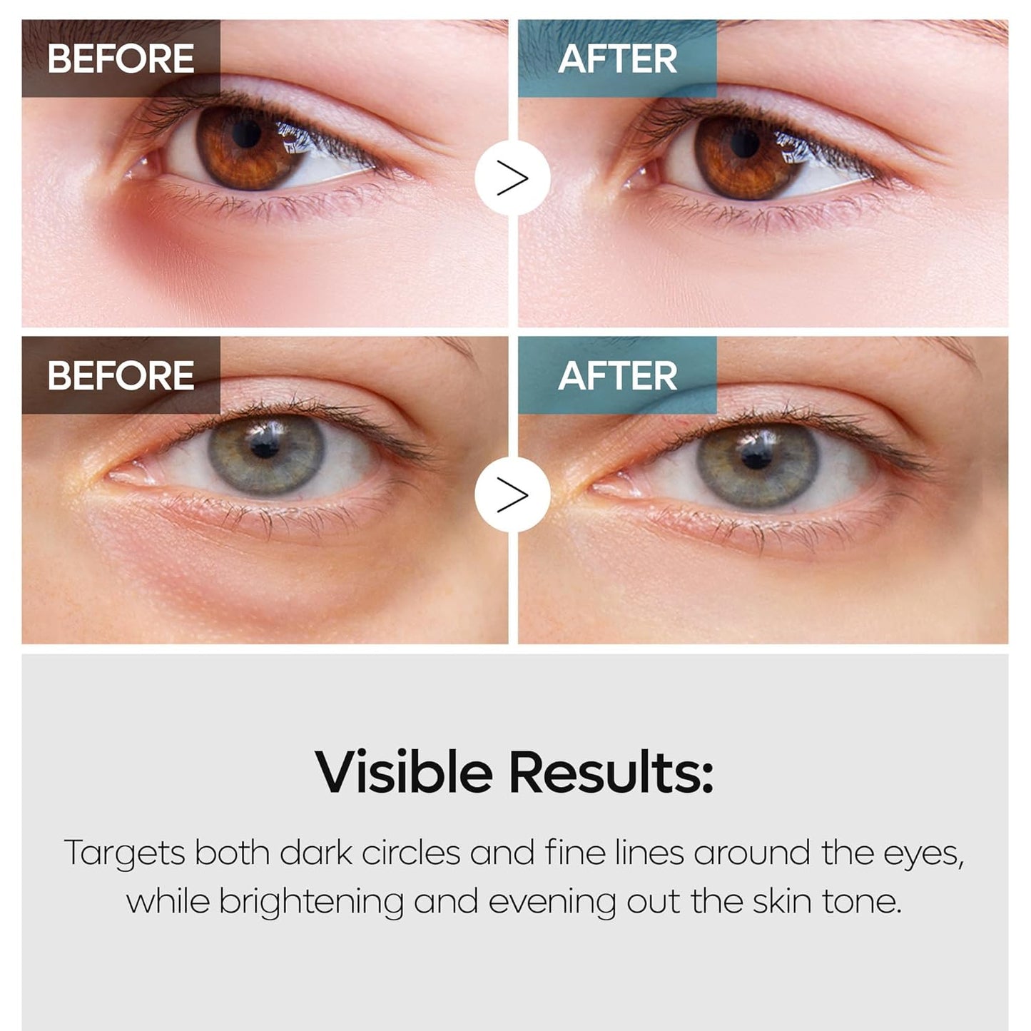 Dr. Melaxin TX Retinalsome Double Effect Eye Cream - Daebak