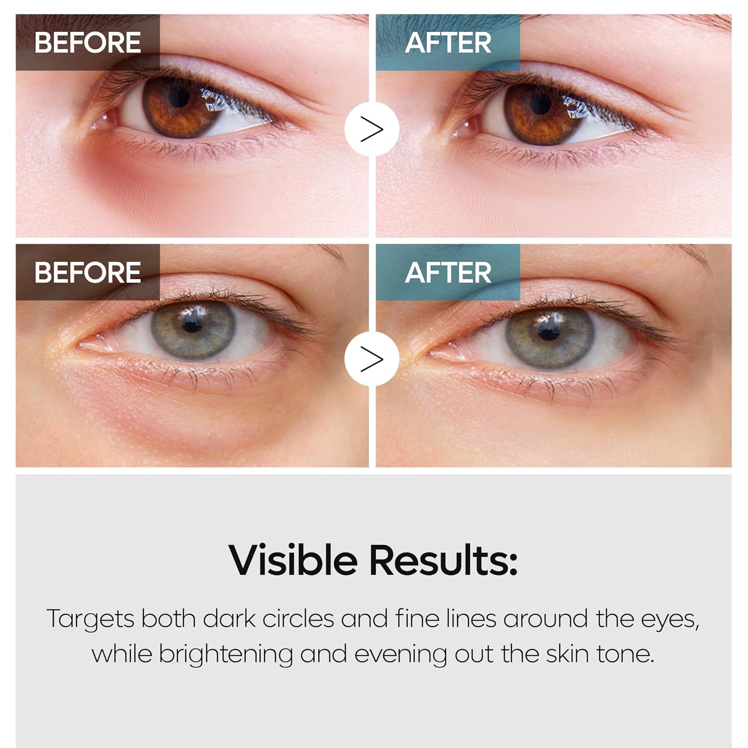 Dr. Melaxin TX Retinalsome Double Effect Eye Cream - Daebak