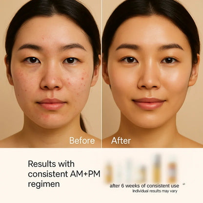 Full-Size Korean Skincare Set for Dark Spots, Fine Lines & Glass Skin - Daebak