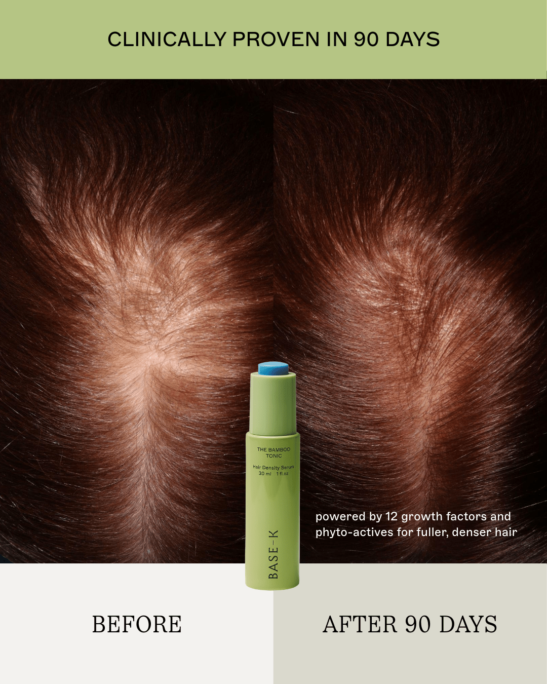 The Hair Density Ritual - The Ultimate 5-Step Renewal - Daebak