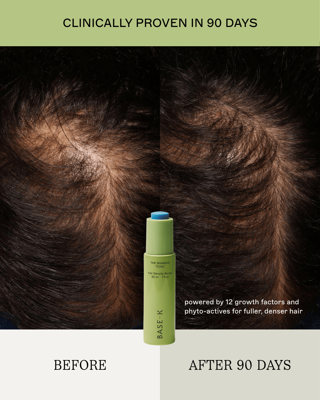 The Hair Density Ritual - The Ultimate 5-Step Renewal - Daebak