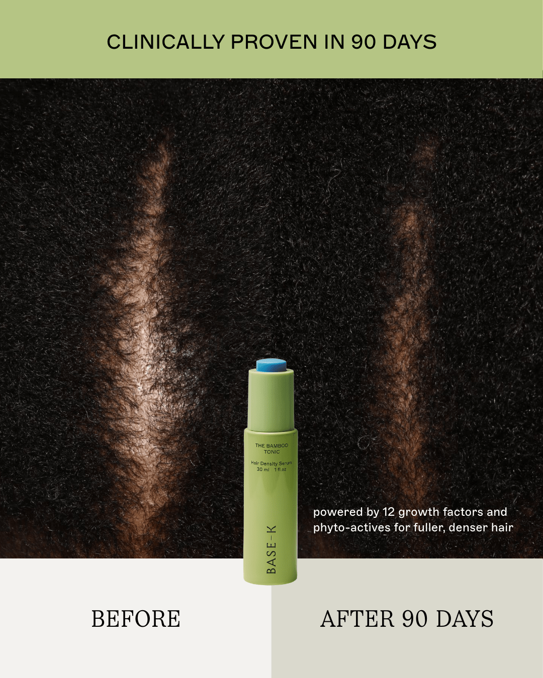 The Hair Density Ritual - The Ultimate 5-Step Renewal - Daebak